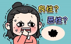 点痣是什么科室检查